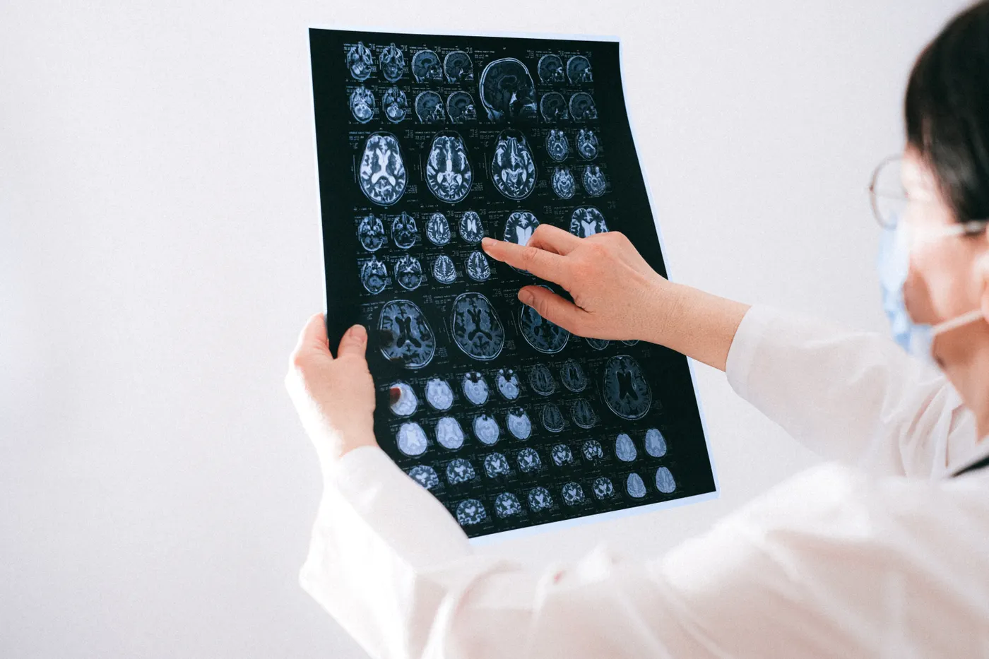 Clinician reviewing brain MRI images used to assess brain structure