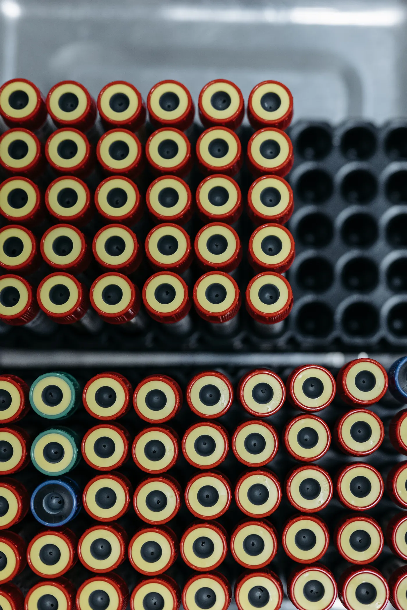 Blood sample test tubes arranged for laboratory analysis